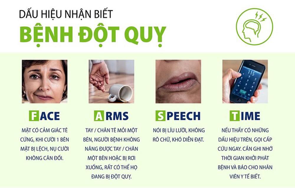 dấu hiệu nhận biết đột quỵ não