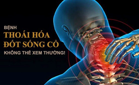 Kết quả hình ảnh cho thoái hóa cột sống